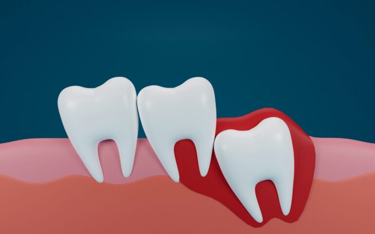 20-lik-dis-cekimi-ankara-scaled